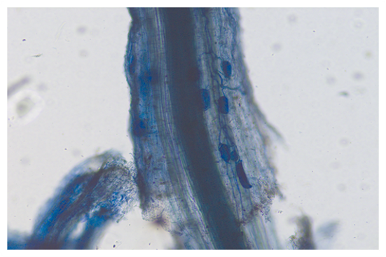 Arbuscular Mycorrhizal Fungi (bright blue structures) inside a Elm root 
